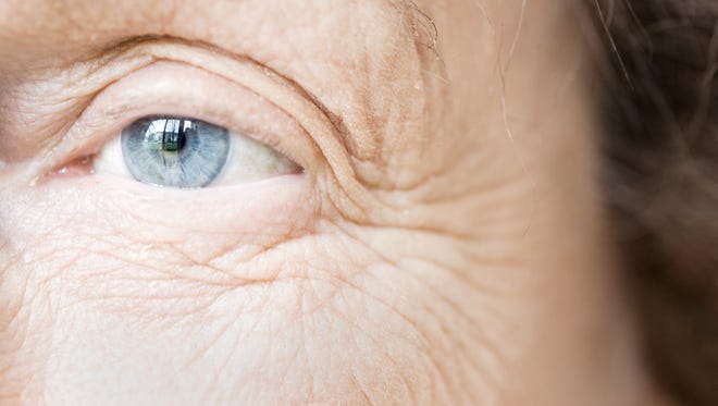 Cedars-Sinai Medical Center researchers say an eye scan can detect Alzheimer's signs years before symptoms appear.